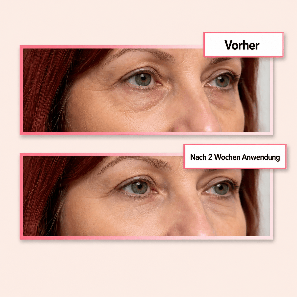 EyeGlow | Keine Augenringe