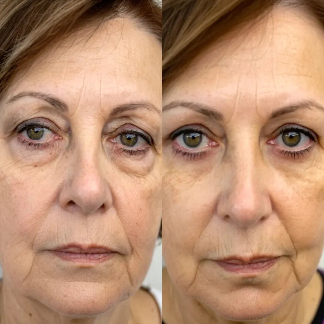 EyeGlow | Keine Augenringe